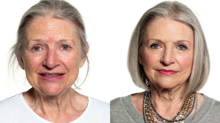 Best nonsurgical beauty enhancement treatments for women over 50